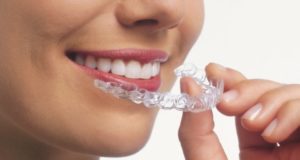kolkata-best-dental-braces