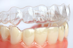 kolkata-best-dental-braces