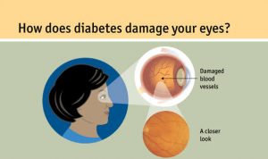 diabetes-treatment