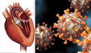 Guest Blog- Does COVID-19 Damage Your Heart?