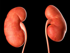 Kidney-Diseases