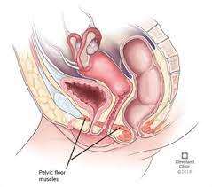 Pelvic-Organ-Prolapse