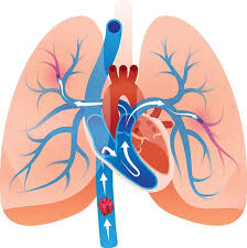 Pulmonary-Thrombectomy