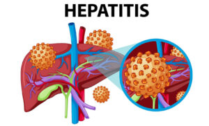 Hepatitis-E