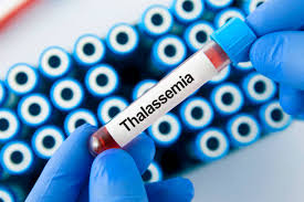 Thalassaemia