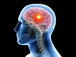 Brain-Tumour-Care Brain-Tumour