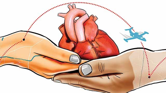 Guest Blog- Scenario Of Heart Transplantation In India
