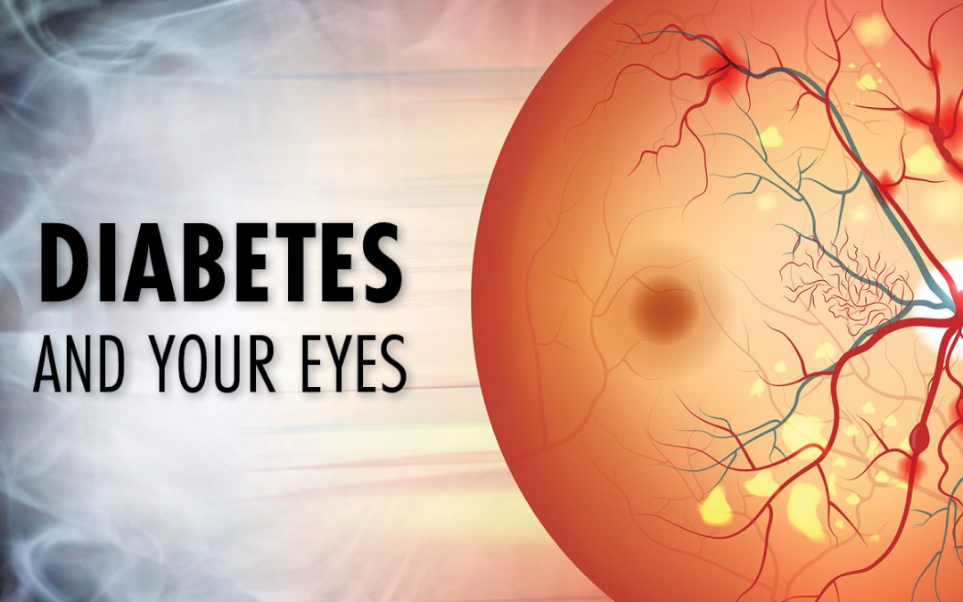 Guest Blog- Diabetes And Eye Diseases