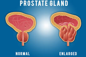Guest Blog: Happy Prostate Essential For Male Well-Being