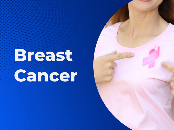 Guest Blog: Complete Guide To Breast Cancer Screening