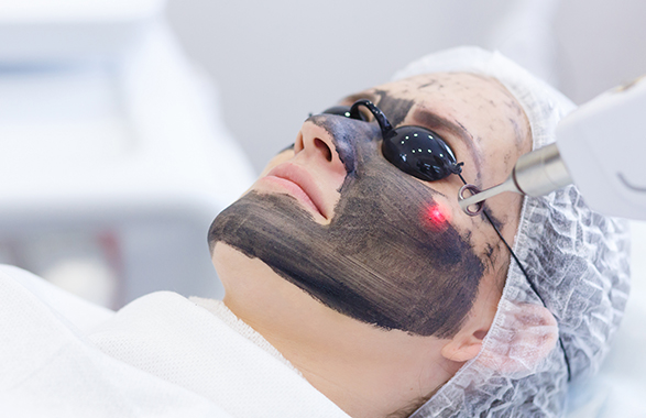 Carbon Laser Peel- Is It Helpful For Rejuvenating Skin?