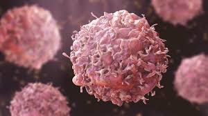 Patients With Stage 4 Metastatic Cancers Can Lead Better Lives