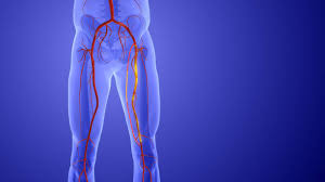 First Advanced Atherectomy Procedure In Kolkata On A 75-Year-Old